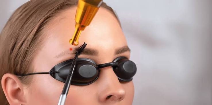 Laser Permanent Makeup Removal Laser Tattoo Removal
